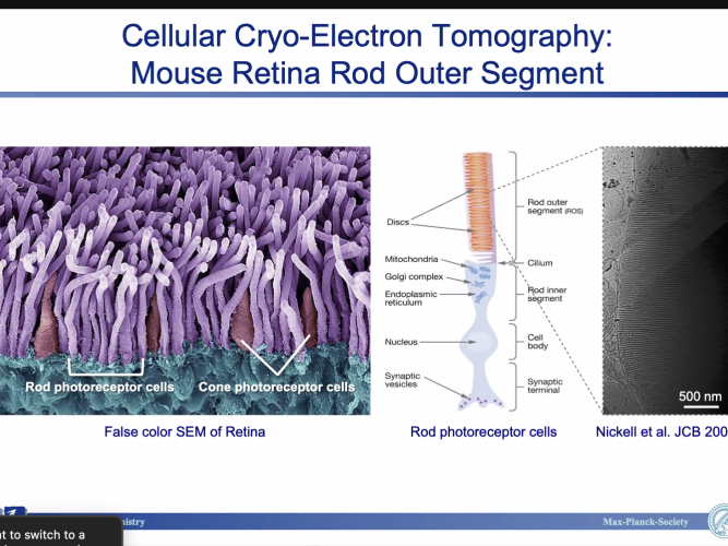 Cellular Cryo-Electron Tomography: Mouse Retina Rod Outer Segment Slide