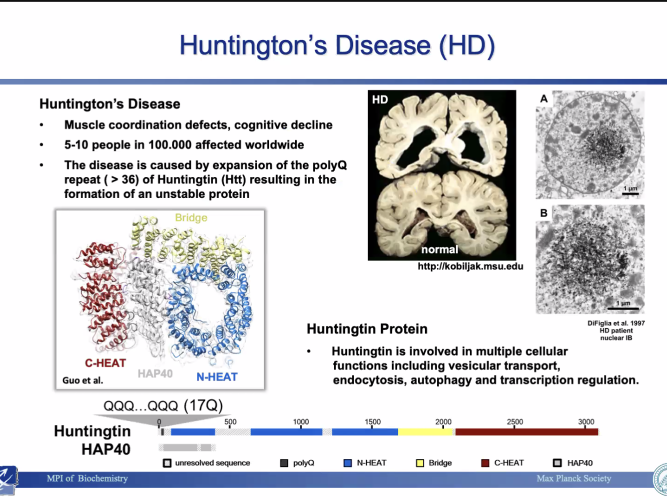 Huntington Disease Slide from the Presentation