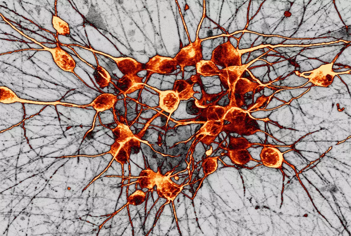 Microscopy image of interconnected neurons glowing orange and red, with branching nerve fibres spreading across a textured grey background.