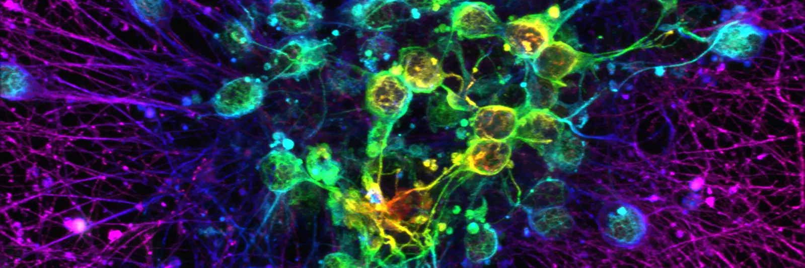 Fluorescence microscopy image of a dense neural network, with branching fibres glowing magenta and purple around clustered cells highlighted in green, yellow and cyan against a black background.